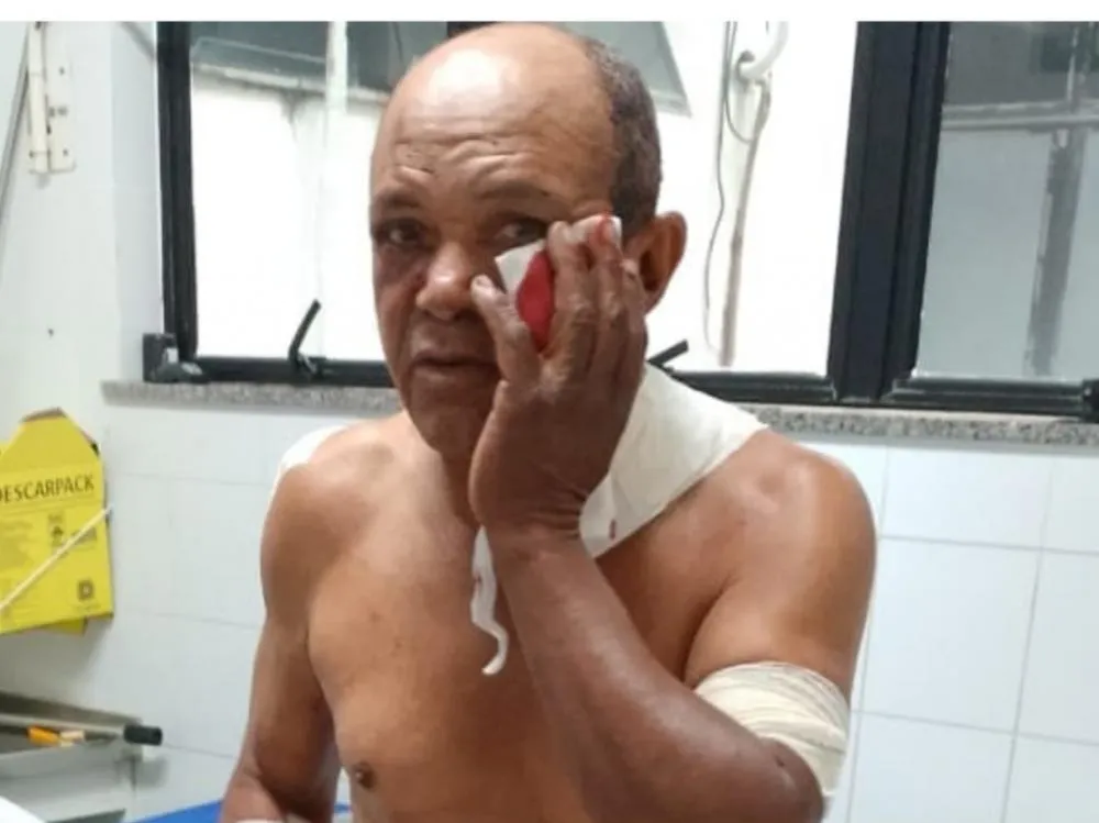 Mecânico vítima de tentativa de homicídio teria sido atraído para emboscada na Meia Hora